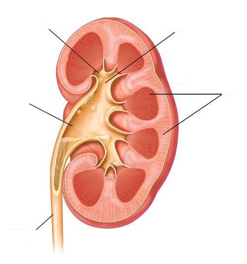 akutni pijelonefritis kao komplikacija cistitisa